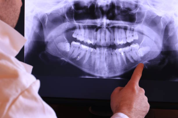 Best Emergency TMJ Treatment in Boiling Springs, PA