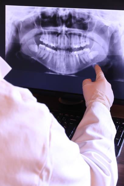 Best Urgent Care for Lost Fillings or Crowns in Boiling Springs, PA